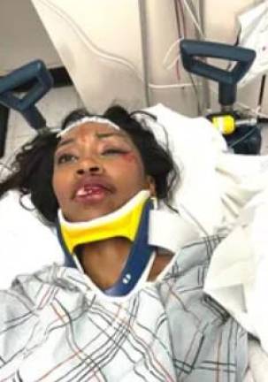 Carrie Bernans faces a long road to recovery after being seriously injured when an allegedly drunk hit-and-run driver hit a food truck which fell on top of her, breaking several bones and knocking her unconscious. She was unable to wak in the days after the New Year’s Day incident. Photo: Go Fund Me